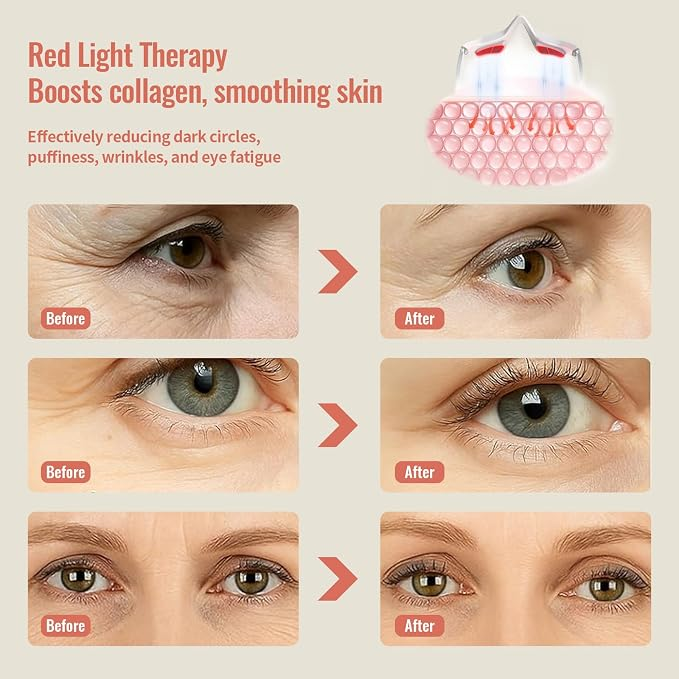 LumiEyes™ | Red Light Eye Massager