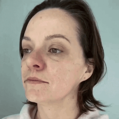 Zenvy Skin™ Red Light Therapy Mask