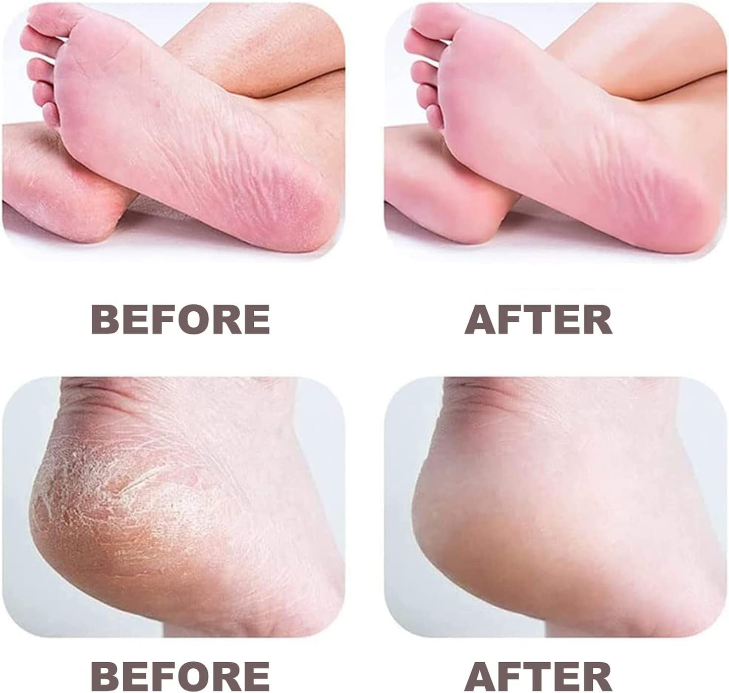 Veloura™ SmoothPro
